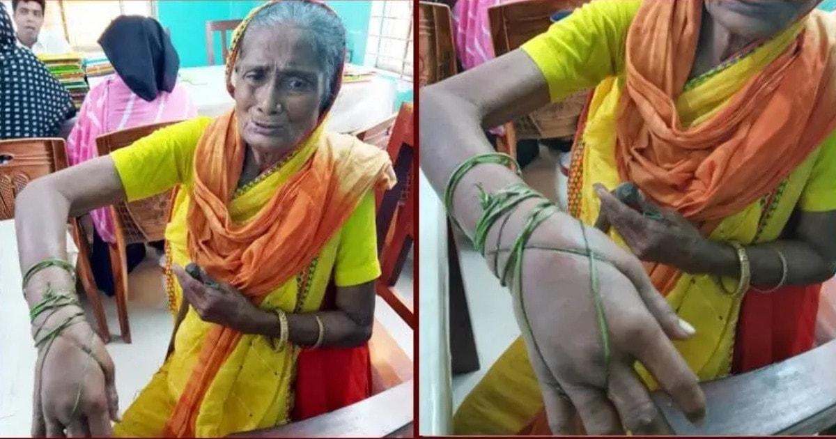 অভাবের কাছে হার মানছে চিকিৎসা, ভাঙা হাত নিয়ে কষ্টে কাঙালিনী সুফিয়া।